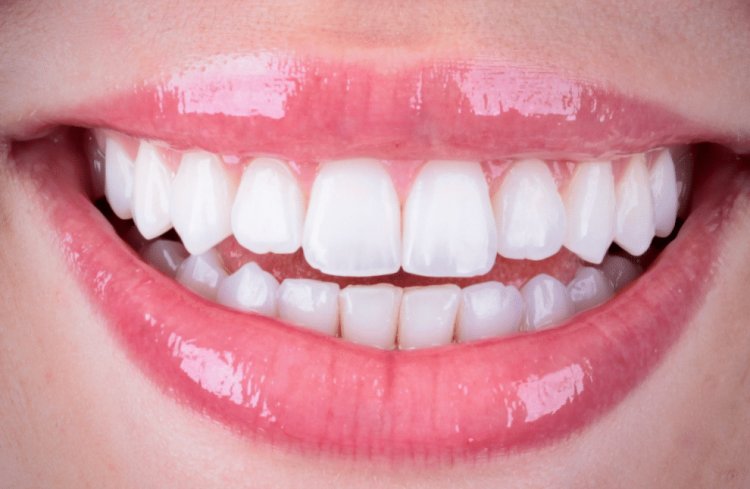 Dor aguda nos dentes: especialista explica causas e como aliviar os sintomas