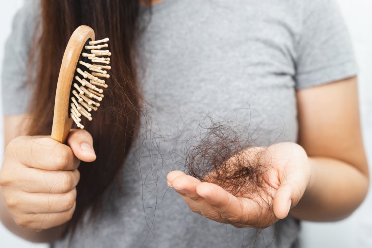 Mitos e verdades sobre queda de cabelo no estresse: diferença entre queda temporária e calvície