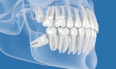 Por que algumas pessoas têm dente do siso, mas outras nunca desenvolvem?