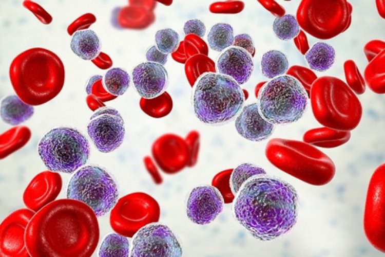 Quando o câncer do sangue não dá sinais: o desafio das leucemias crônicas